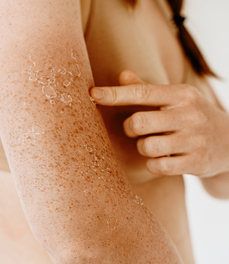 Cura psoriasi